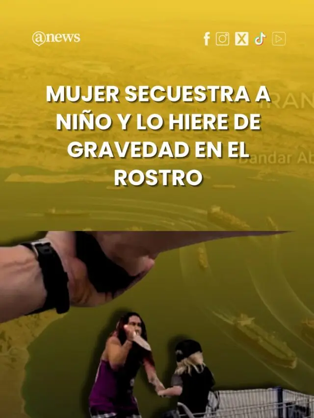 Mujer secuestra a niño y lo hiere de gravedad en el rostro